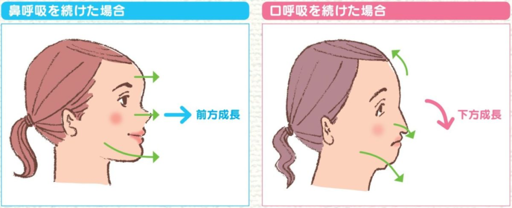 Bên trái: thở bằng mũi, các nét sẽ hướng về phía trước Bên phải: thở bằng miệng, các nét sẽ hướng xuống dưới